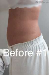 Fat Reduction