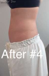 Fat Reduction