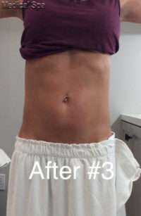 Fat Reduction